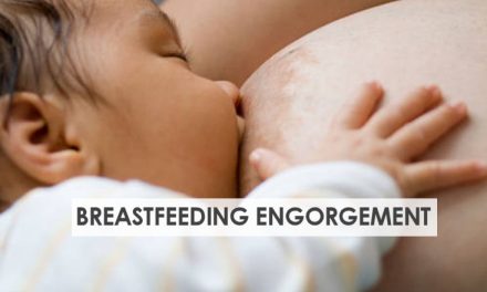 Breastfeeding Engorgement – How to Relieve Engorged Breasts
