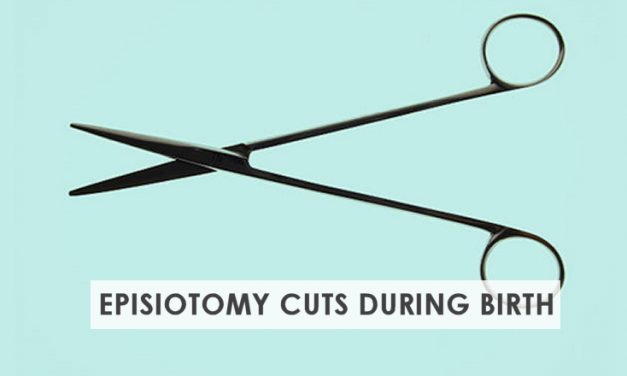 Episiotomy Cut – Make an Informed Choice During Delivery