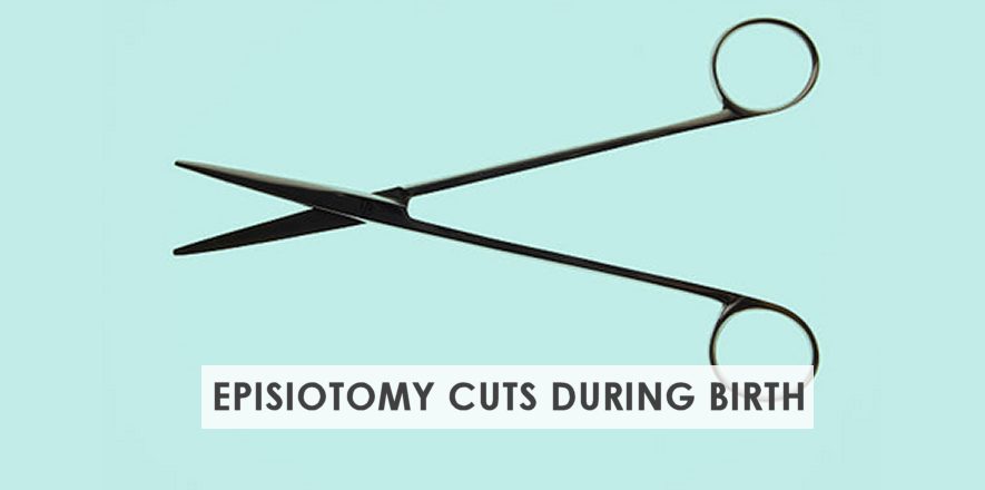 Episiotomy Cut – Make an Informed Choice During Delivery
