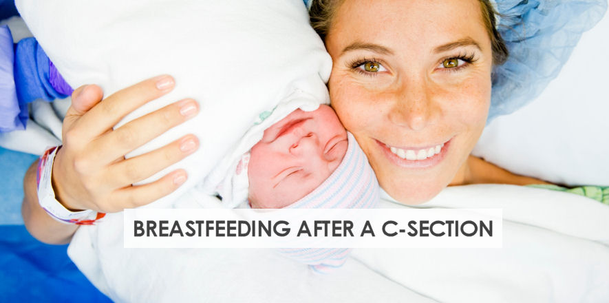 Breastfeeding after A C-Section – New Moms Guide