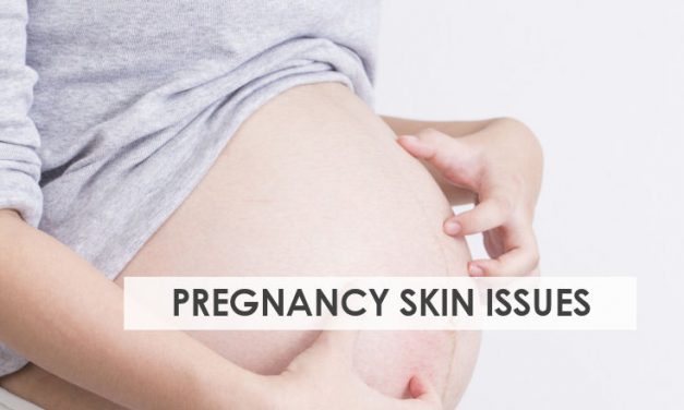 8 Pregnancy Skin Issues And Incredibly Easy Ways To Fix Them